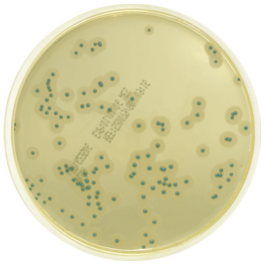 Medio cromogénico para especies de Listeria 