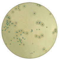 Medio cromogénico Listeria monocytogenes