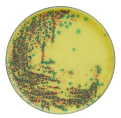 Medio cromogénico – Salmonella